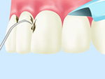 STEP01歯と歯肉のチェック